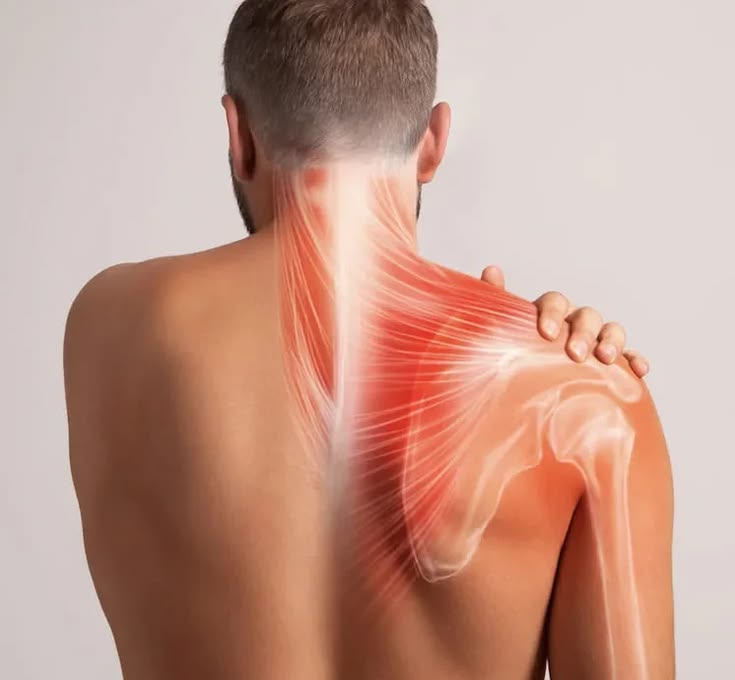 Shoulder Pain